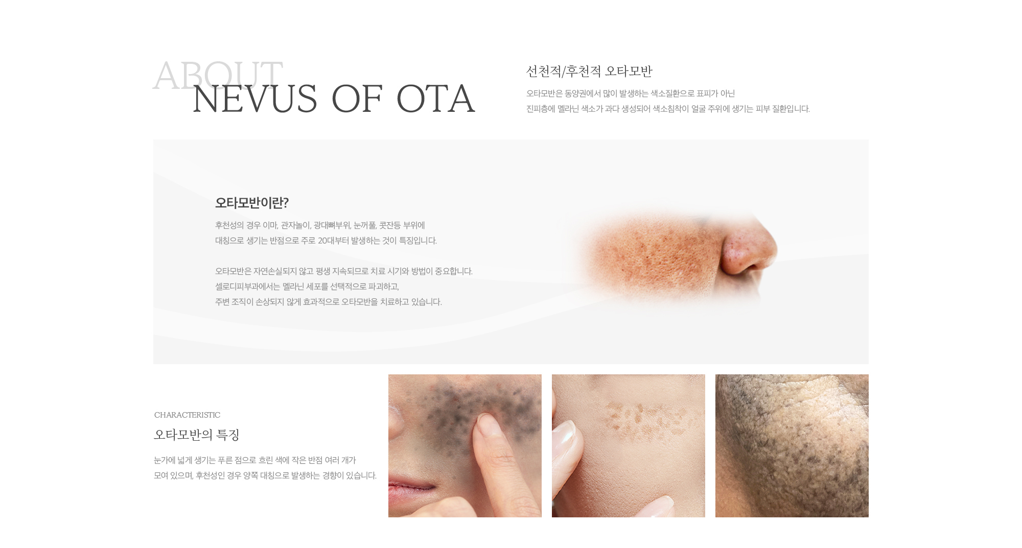 선천적/후천적 오타모반